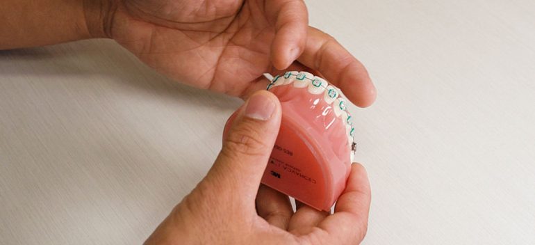 Orthodontist In St. Johns Fl